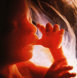 fetus, 18 weeks old